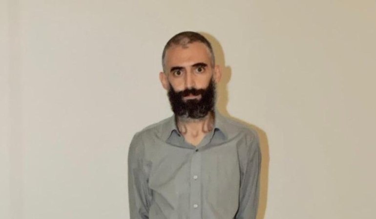gurkan-turkoglu